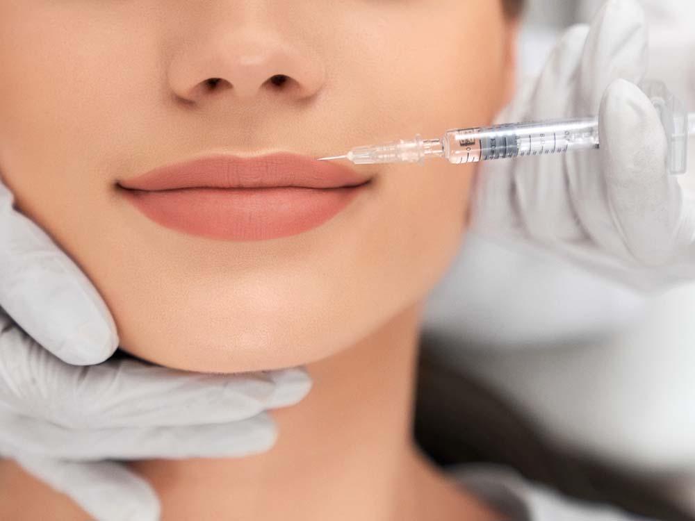 Filler labbra a Gattinara